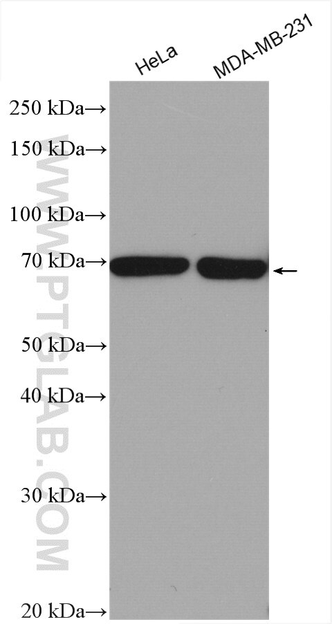 Western Blot (WB) analysis of various lysates using ANKRD13C Polyclonal antibody (24000-1-AP)