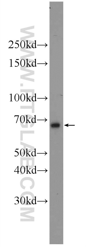 Western Blot (WB) analysis of mouse testis tissue using ANKRD13C Polyclonal antibody (24000-1-AP)