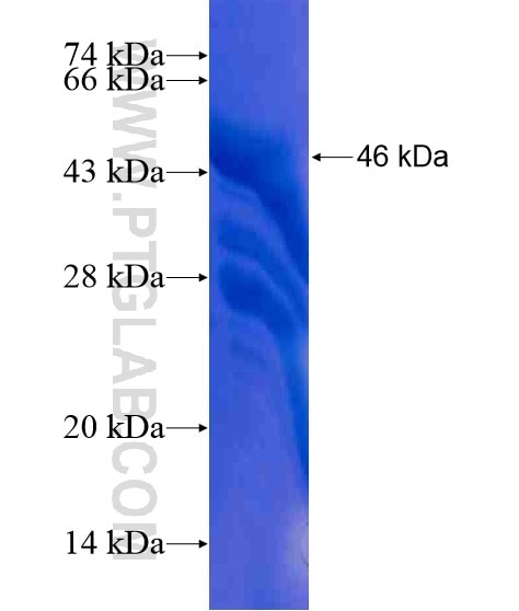 ANKRD13C fusion protein Ag21202 SDS-PAGE