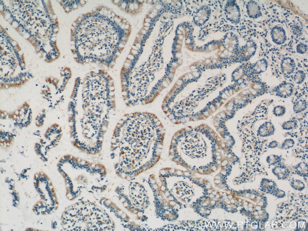 Immunohistochemistry (IHC) staining of human small intestine tissue using ANKRD13D Polyclonal antibody (21100-1-AP)