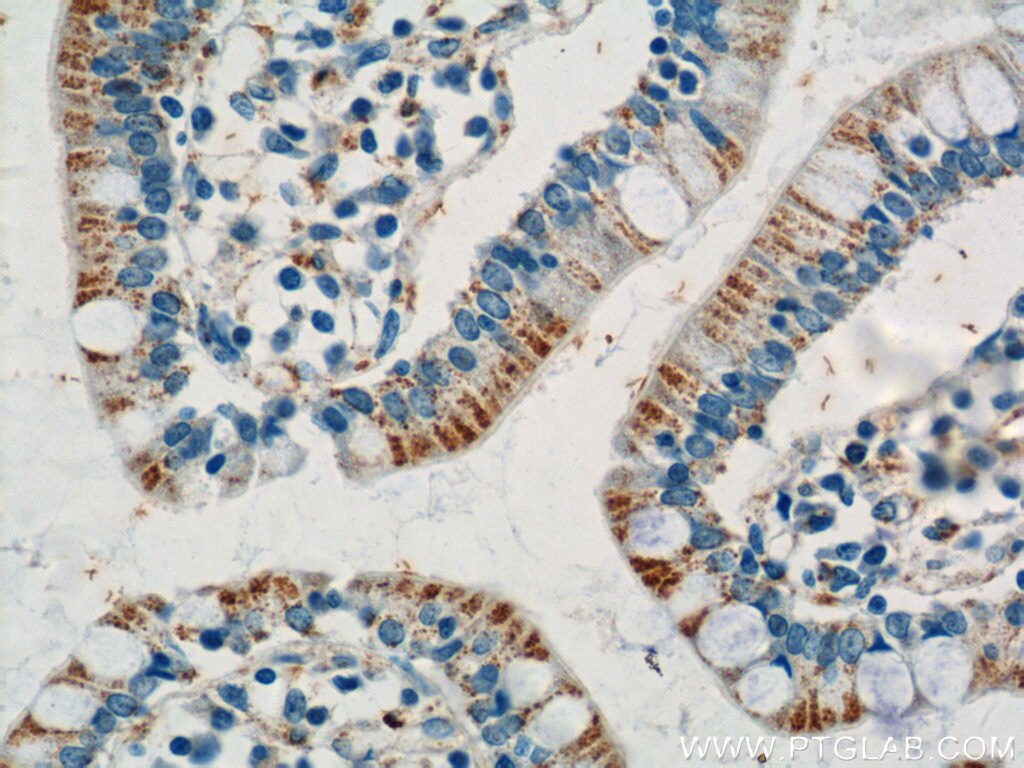 Immunohistochemistry (IHC) staining of human small intestine tissue using ANKRD13D Polyclonal antibody (21100-1-AP)