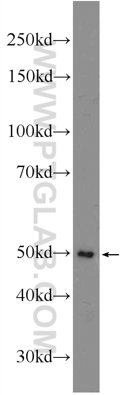 Western Blot (WB) analysis of Jurkat cells using ANKRD13D Polyclonal antibody (21100-1-AP)