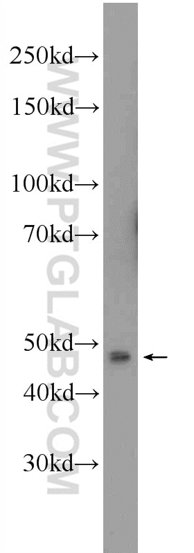 Western Blot (WB) analysis of HT-1080 cells using ANKRD13D Polyclonal antibody (21100-1-AP)