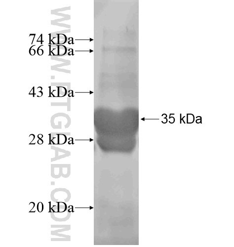 ANKRD13D fusion protein Ag15369 SDS-PAGE