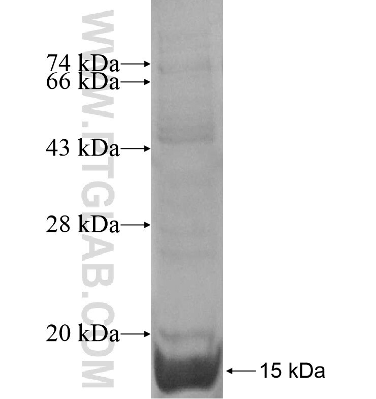 ANKRD13D fusion protein Ag16913 SDS-PAGE