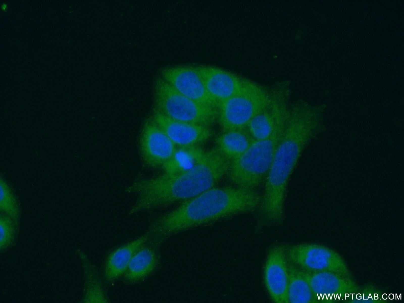 Immunofluorescence (IF) / fluorescent staining of HeLa cells using ANKRD16 Polyclonal antibody (24334-1-AP)