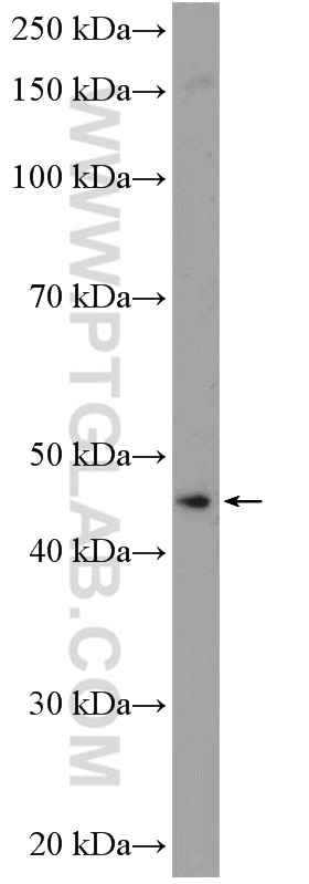 Western Blot (WB) analysis of PC-3 cells using ANKRD16 Polyclonal antibody (24334-1-AP)