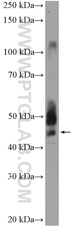 Western Blot (WB) analysis of mouse liver tissue using ANKRD16 Polyclonal antibody (24334-1-AP)
