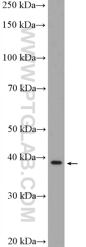 Western Blot (WB) analysis of HeLa cells using ANKRD16 Polyclonal antibody (24334-1-AP)
