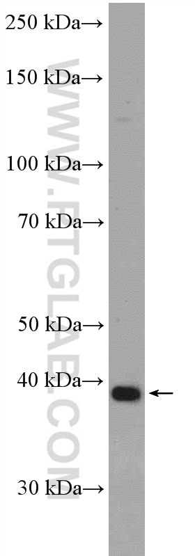 Western Blot (WB) analysis of PC-3 cells using ANKRD16 Polyclonal antibody (24334-1-AP)