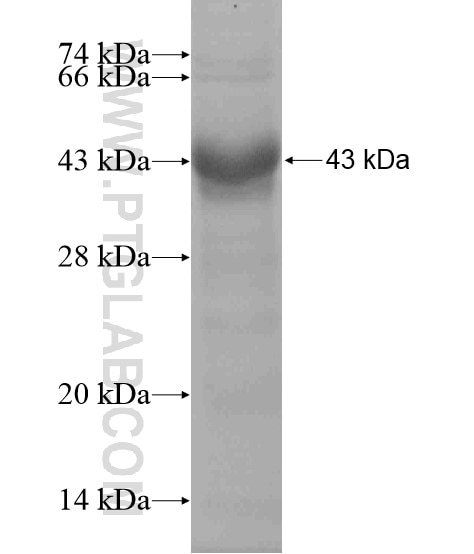 ANKRD16 fusion protein Ag19369 SDS-PAGE