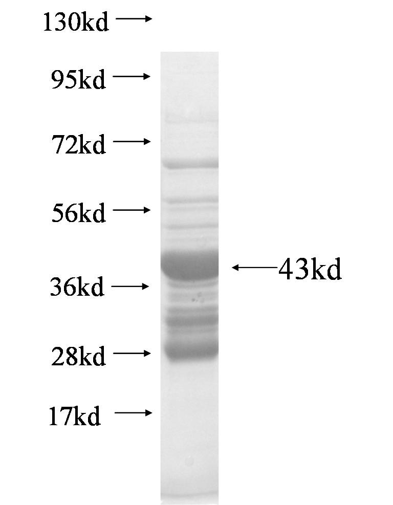 ANKRD16 fusion protein Ag7185 SDS-PAGE