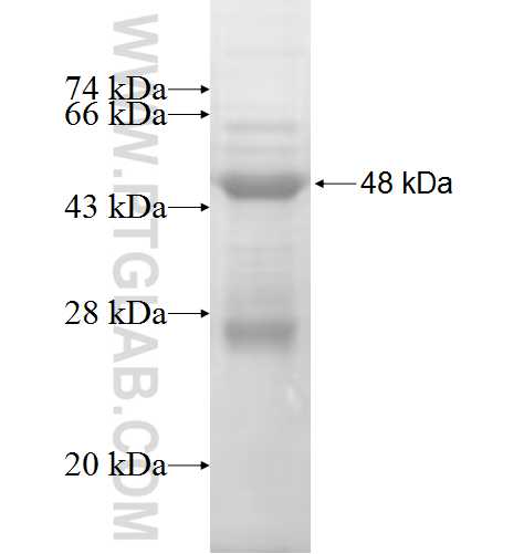 ANKRD16 fusion protein Ag7186 SDS-PAGE