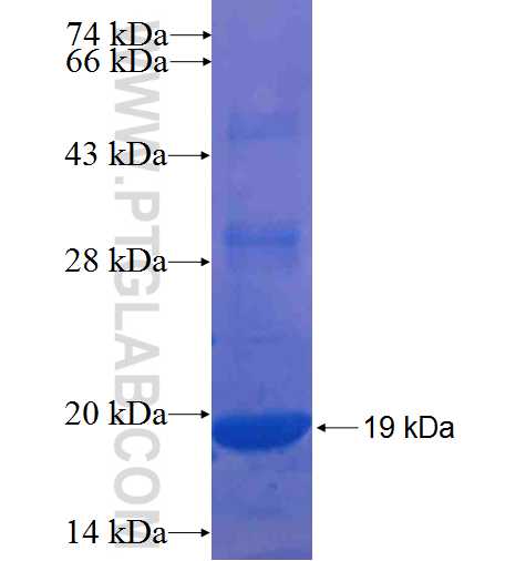 ANKRD16 fusion protein Ag7341 SDS-PAGE