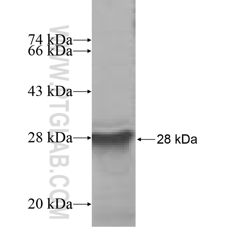 ANKRD16 fusion protein Ag7343 SDS-PAGE