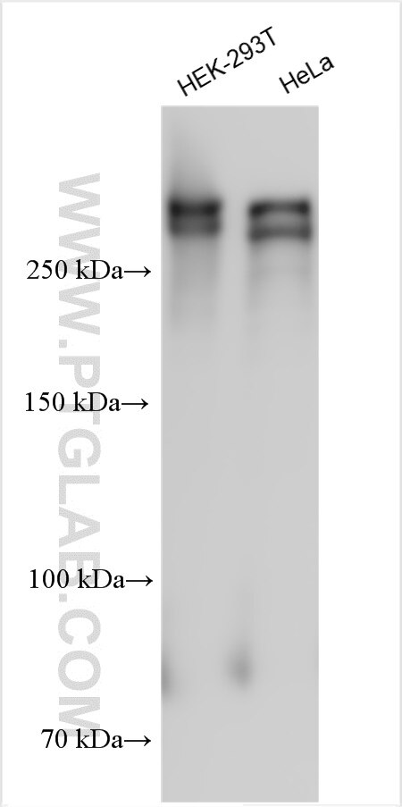 Western Blot (WB) analysis of various lysates using ANKRD17 Polyclonal antibody (27701-1-AP)