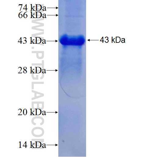 ANKRD17 fusion protein Ag26767 SDS-PAGE