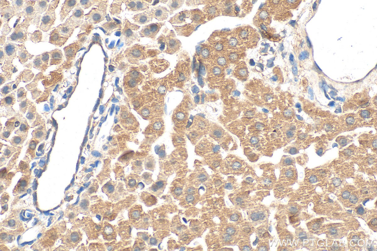 Immunohistochemistry (IHC) staining of mouse liver tissue using ANKRD18A Polyclonal antibody (24087-1-AP)