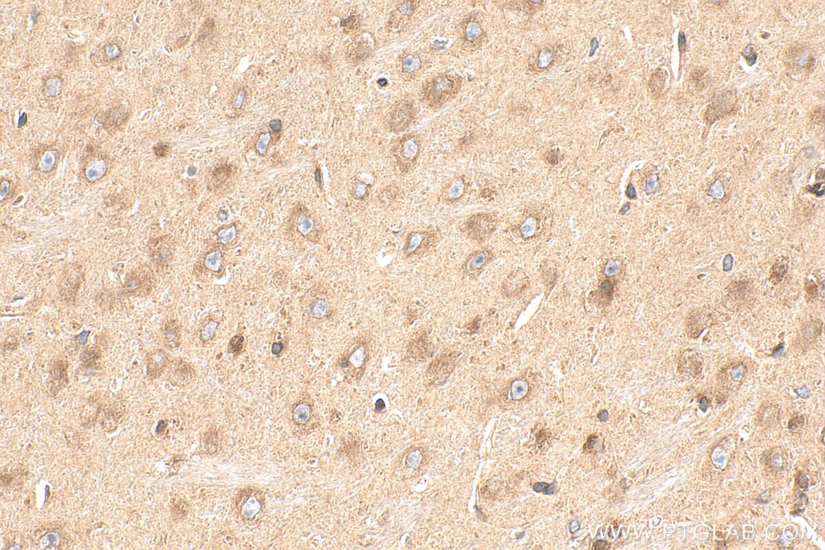 Immunohistochemistry (IHC) staining of mouse brain tissue using ANKRD18A Polyclonal antibody (24087-1-AP)