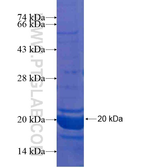 ANKRD18A fusion protein Ag21335 SDS-PAGE