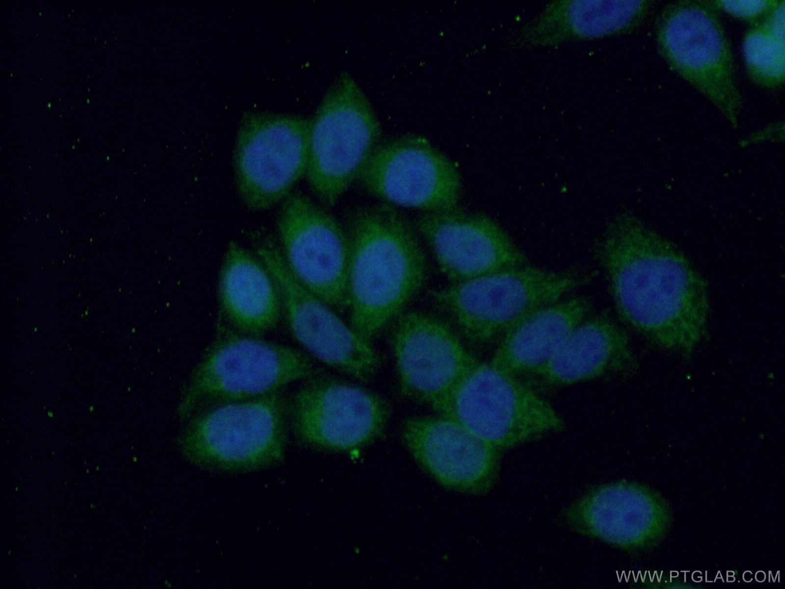 Immunofluorescence (IF) / fluorescent staining of HeLa cells using ANKRD2 Polyclonal antibody (11821-1-AP)