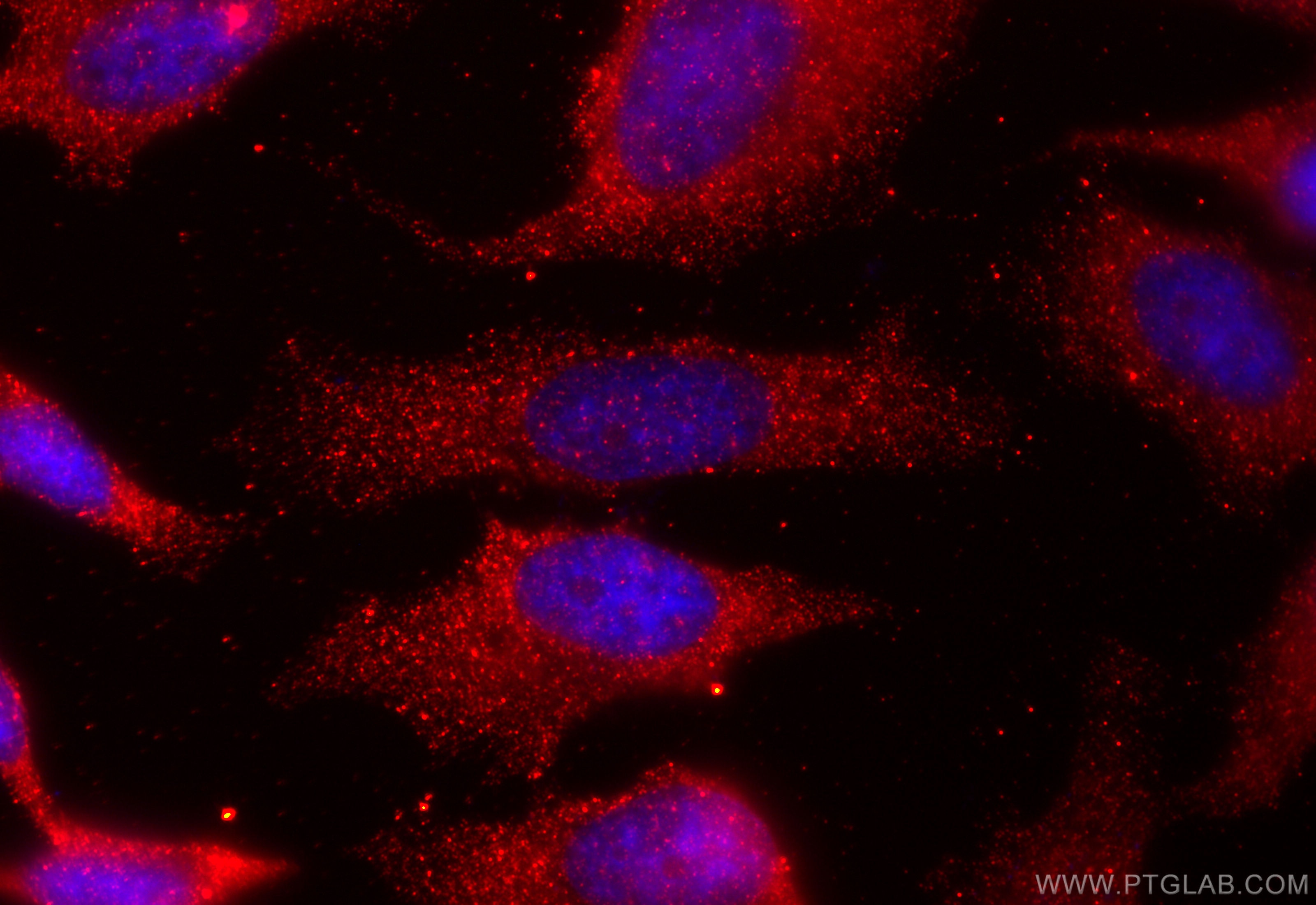 Immunofluorescence (IF) / fluorescent staining of HeLa cells using ANKRD2 Polyclonal antibody (11821-1-AP)