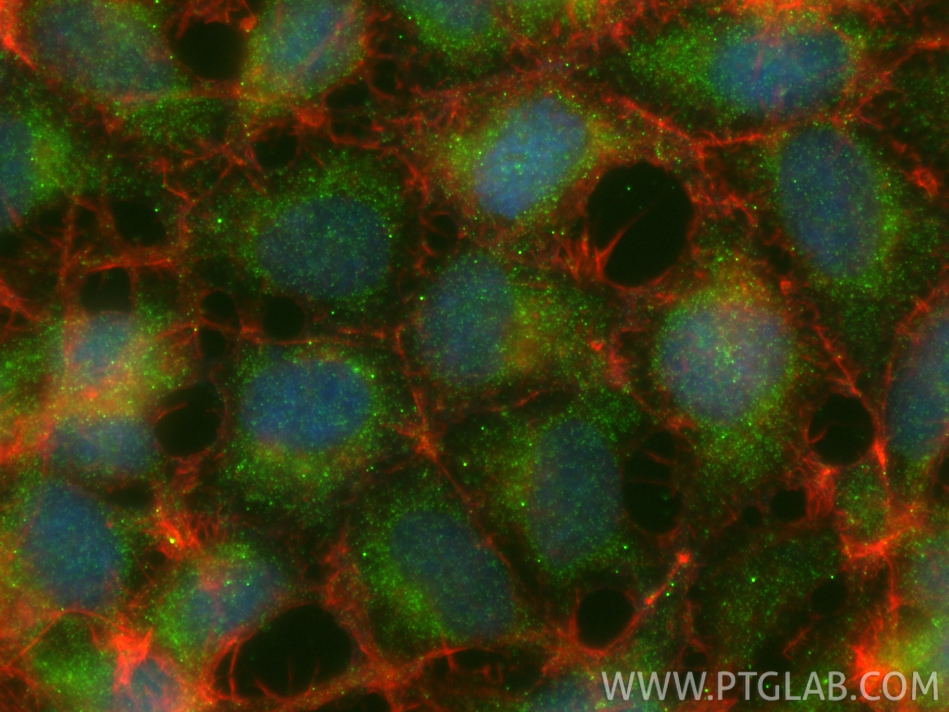 IF Staining of HEK-293 using 11821-1-AP Immunofluorescence (IF) / fluorescent staining of HEK-293 cells using ANKRD2 Polyclonal antibody (11821-1-AP)