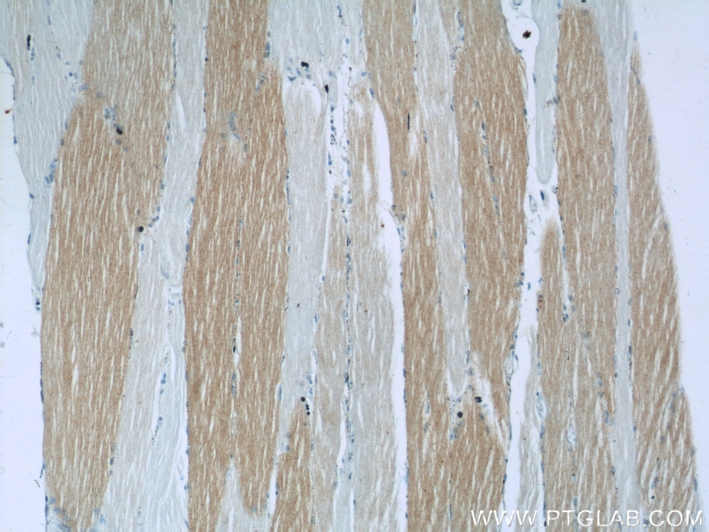 IHC staining of human skeletal muscle using 11821-1-AP