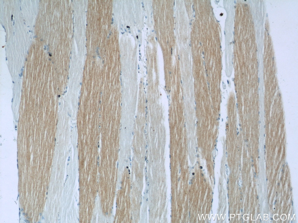 Immunohistochemistry (IHC) staining of human skeletal muscle tissue using ANKRD2 Polyclonal antibody (11821-1-AP)