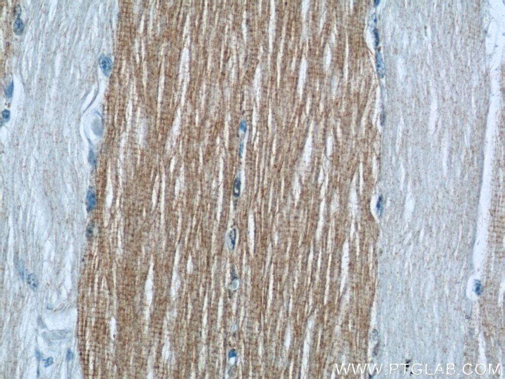 Immunohistochemistry (IHC) staining of human skeletal muscle tissue using ANKRD2 Polyclonal antibody (11821-1-AP)