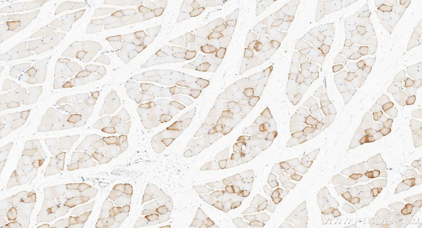 IHC staining of rat skeletal muscle using 11821-1-AP Immunohistochemistry (IHC) staining of rat skeletal muscle tissue using ANKRD2 Polyclonal antibody (11821-1-AP)