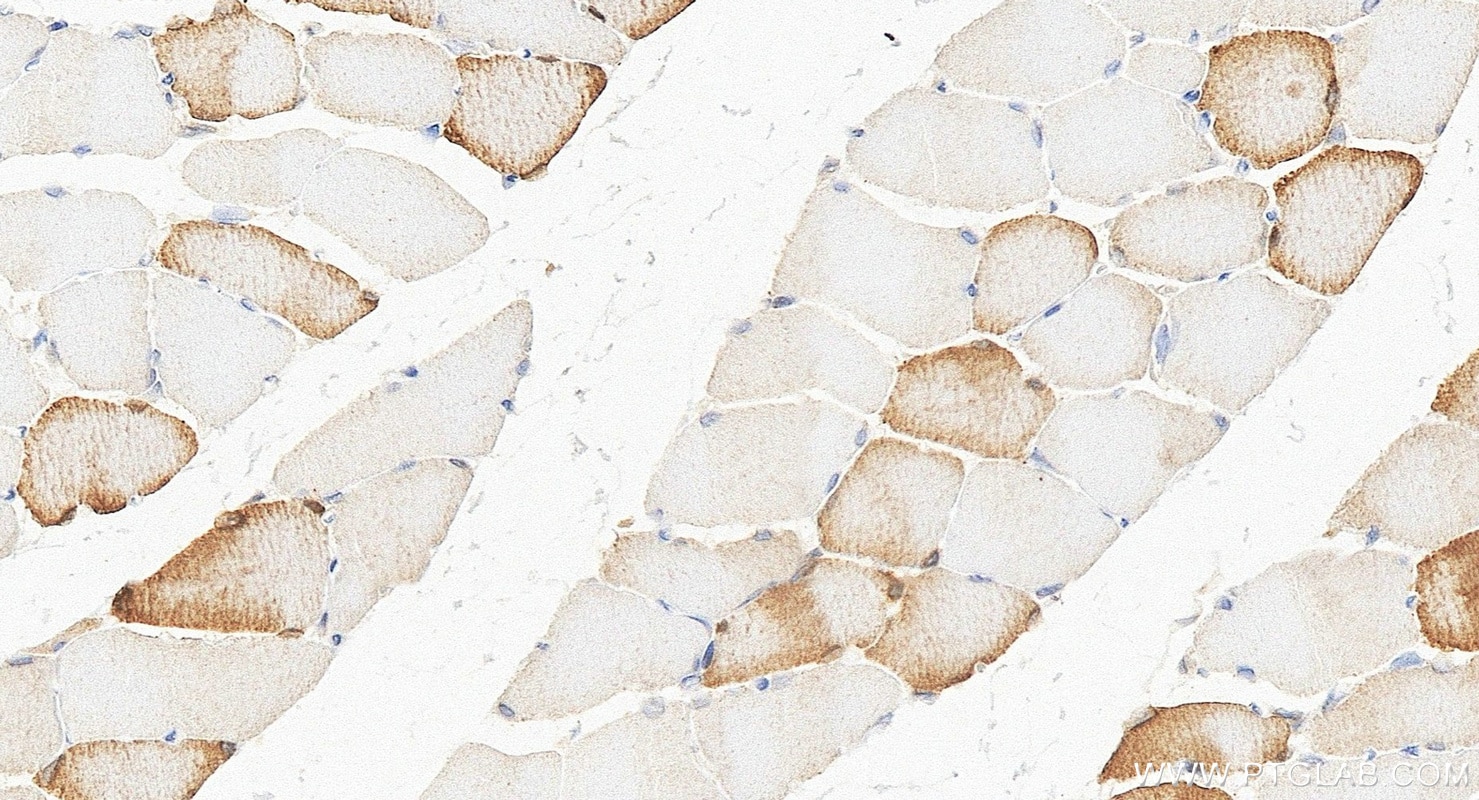 IHC staining of rat skeletal muscle using 11821-1-AP Immunohistochemistry (IHC) staining of rat skeletal muscle tissue using ANKRD2 Polyclonal antibody (11821-1-AP)