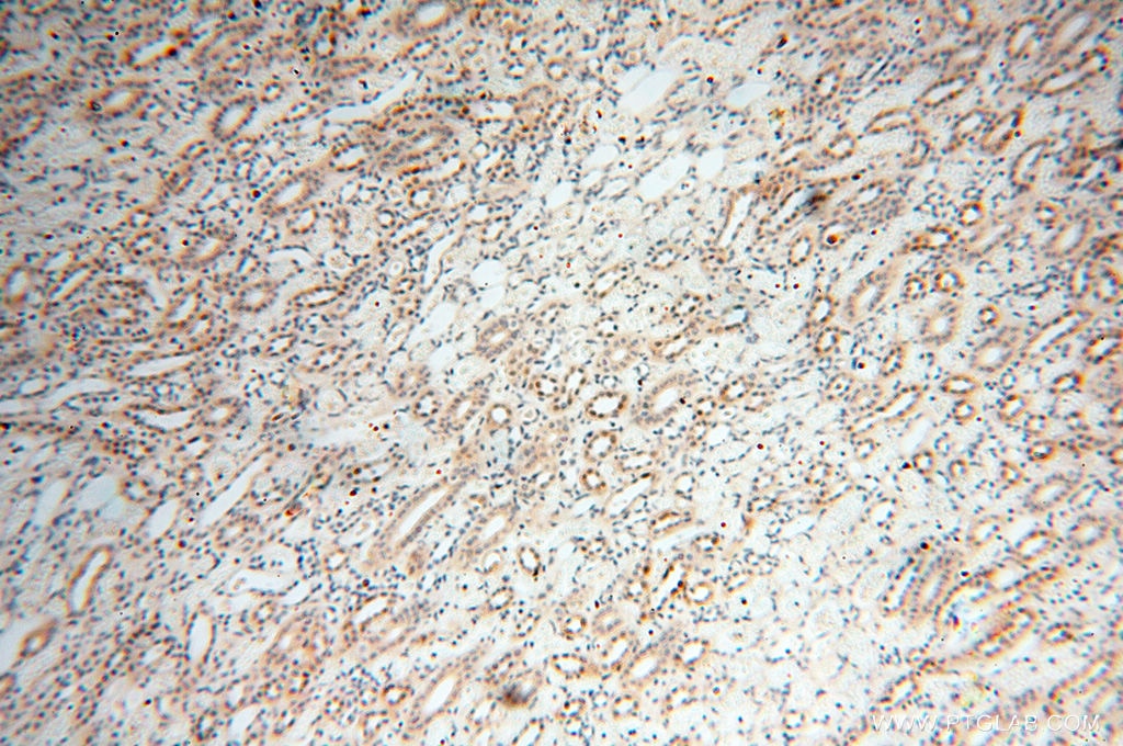 Immunohistochemistry (IHC) staining of human kidney tissue using ANKRD2 Polyclonal antibody (11821-1-AP)