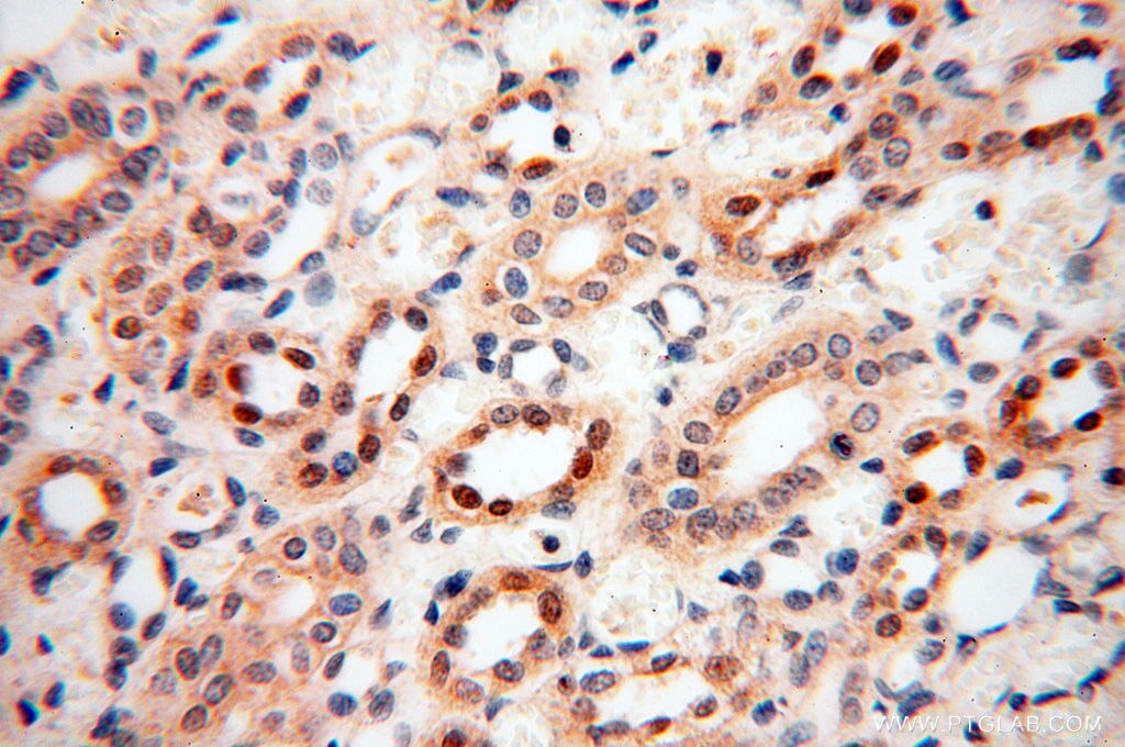 Immunohistochemistry (IHC) staining of human kidney tissue using ANKRD2 Polyclonal antibody (11821-1-AP)