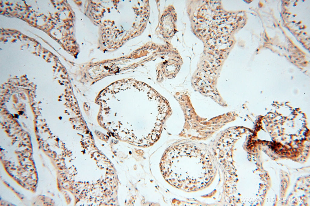 Immunohistochemistry (IHC) staining of human testis tissue using ANKRD2 Polyclonal antibody (11821-1-AP)
