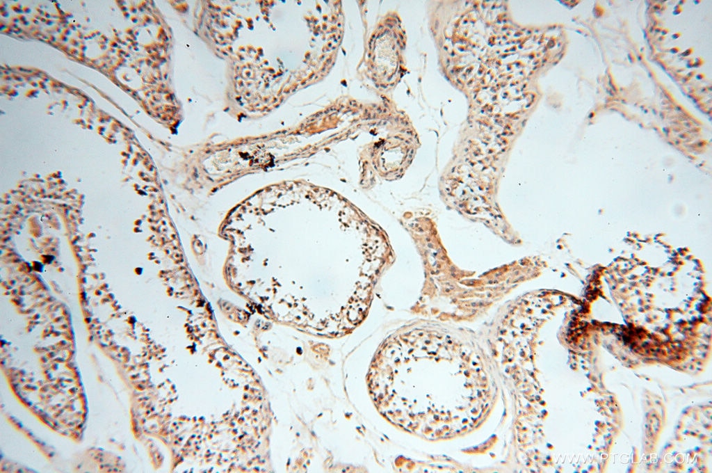 IHC staining of human testis using 11821-1-AP