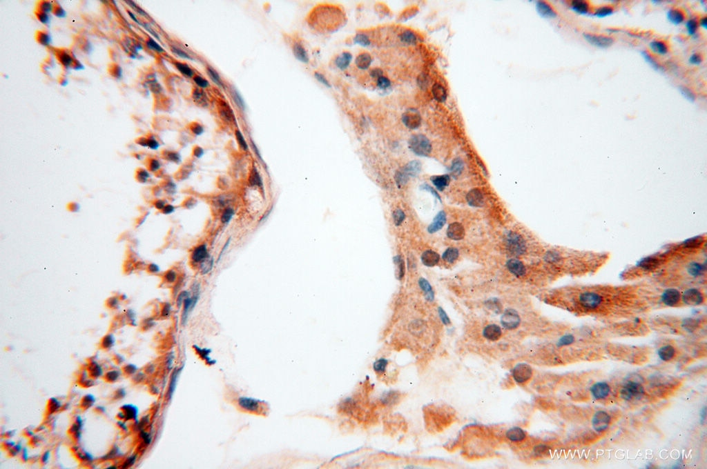 Immunohistochemistry (IHC) staining of human testis tissue using ANKRD2 Polyclonal antibody (11821-1-AP)