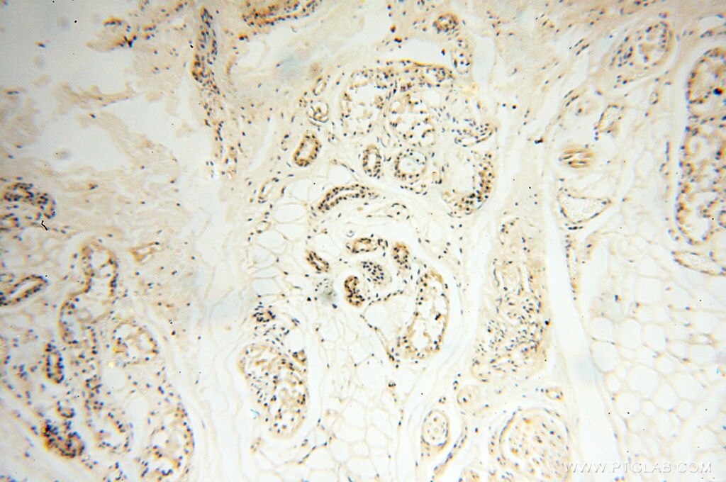 Immunohistochemistry (IHC) staining of human skin tissue using ANKRD2 Polyclonal antibody (11821-1-AP)