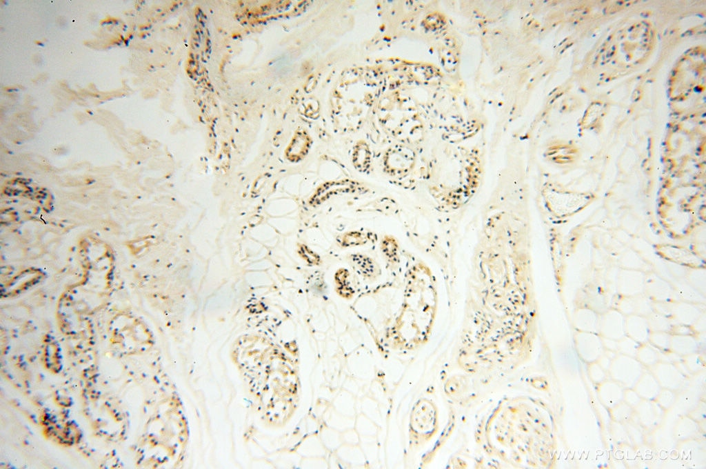 IHC staining of human skin using 11821-1-AP