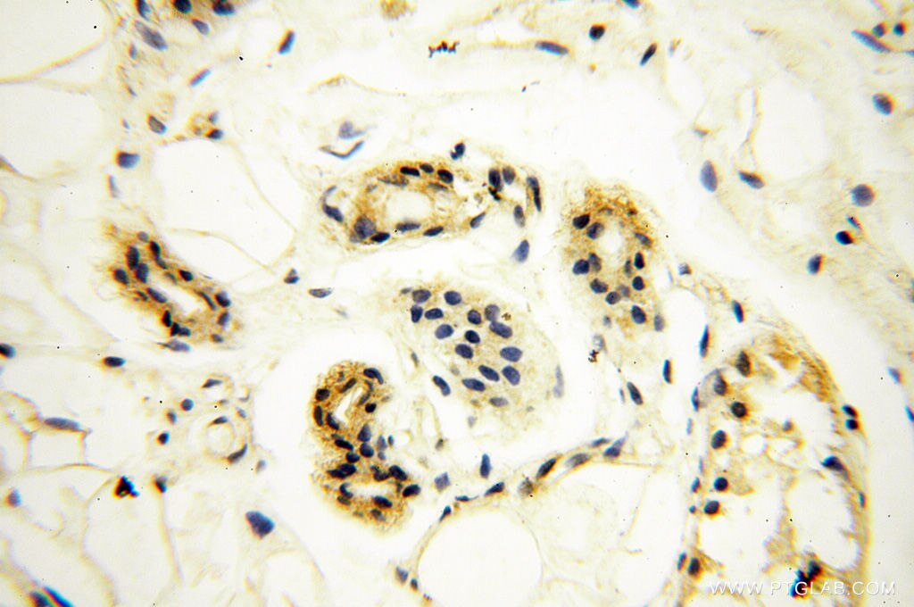 Immunohistochemistry (IHC) staining of human skin tissue using ANKRD2 Polyclonal antibody (11821-1-AP)