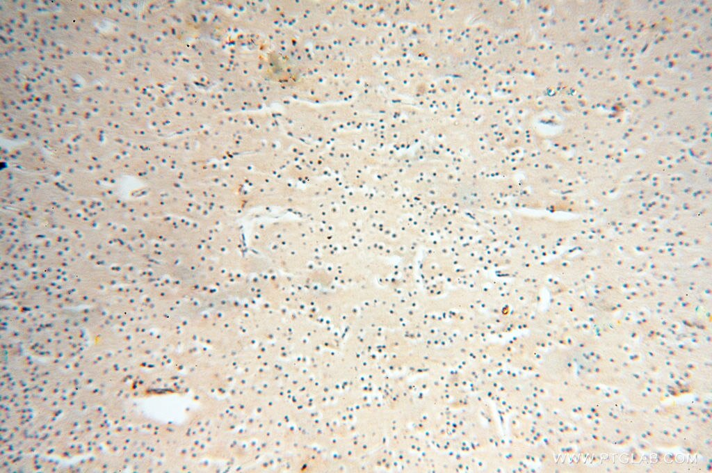 Immunohistochemistry (IHC) staining of human brain tissue using ANKRD2 Polyclonal antibody (11821-1-AP)