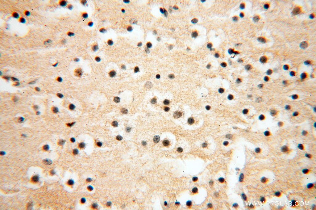 Immunohistochemistry (IHC) staining of human brain tissue using ANKRD2 Polyclonal antibody (11821-1-AP)