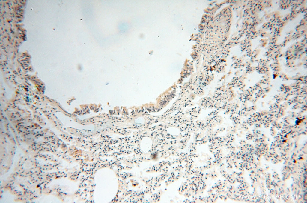 Immunohistochemistry (IHC) staining of human lung tissue using ANKRD2 Polyclonal antibody (11821-1-AP)