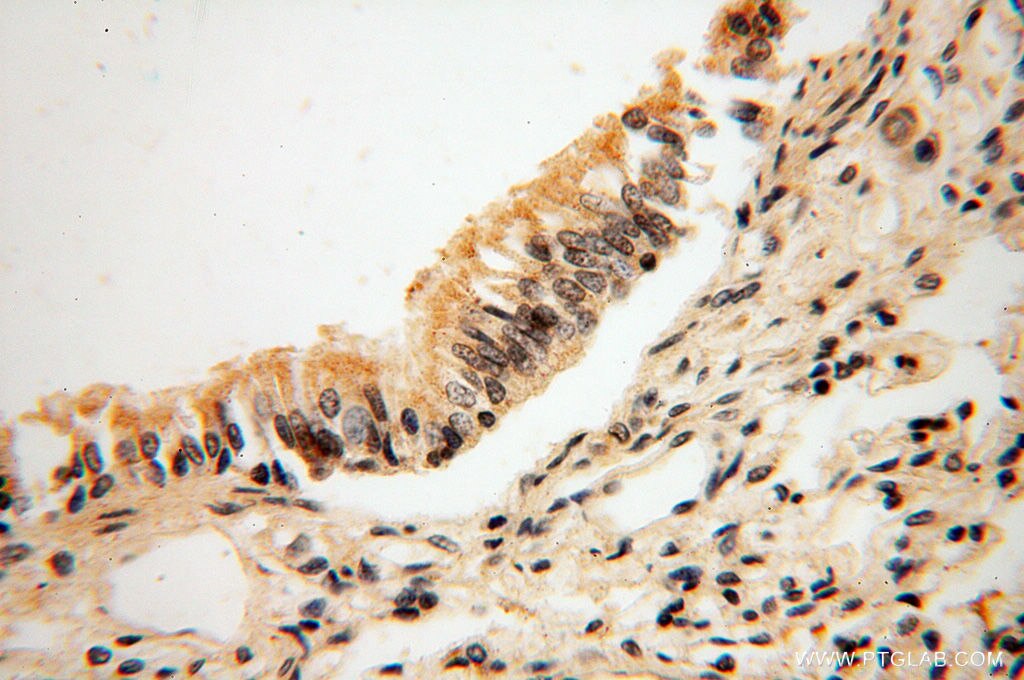 IHC staining of human lung using 11821-1-AP