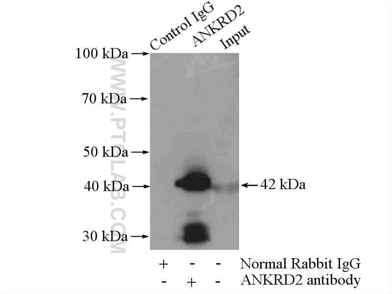 Immunoprecipitation (IP) experiment of mouse skeletal muscle tissue using ANKRD2 Polyclonal antibody (11821-1-AP)