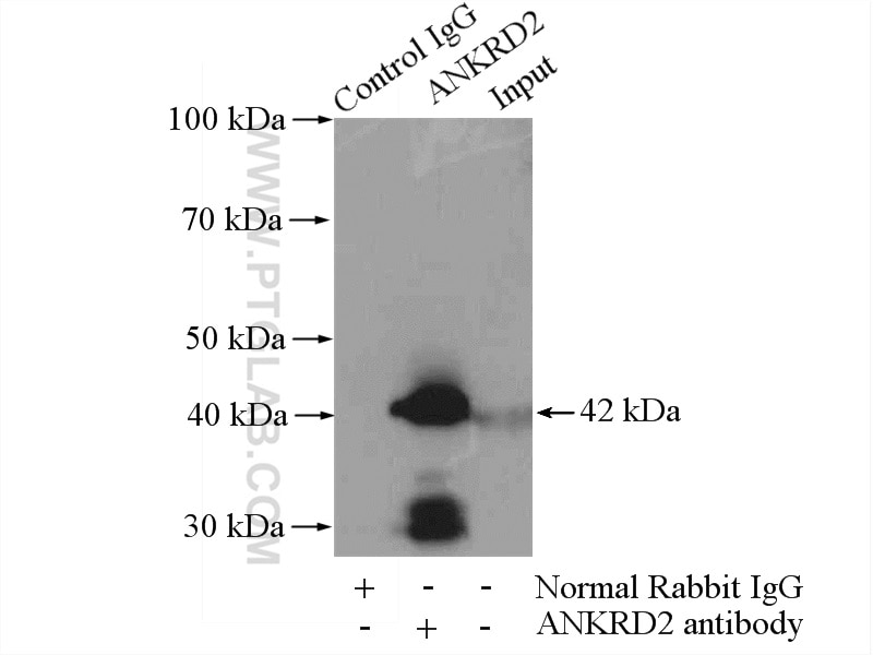 IP experiment of mouse skeletal muscle using 11821-1-AP