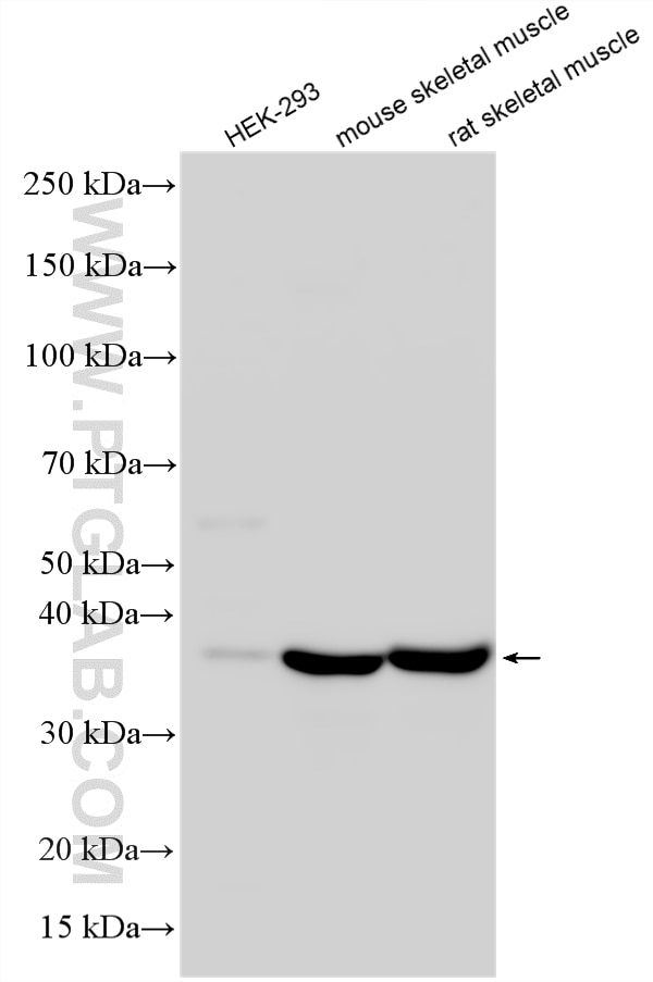Western Blot (WB) analysis of various lysates using ANKRD2 Polyclonal antibody (11821-1-AP)