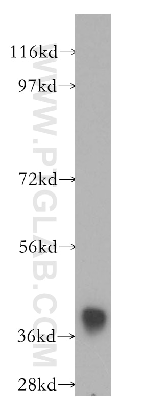 Western Blot (WB) analysis of human skeletal muscle tissue using ANKRD2 Polyclonal antibody (11821-1-AP)