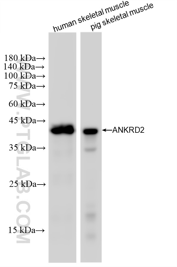 Western Blot (WB) analysis of various lysates using ANKRD2 Recombinant monoclonal antibody (87444-1-RR)