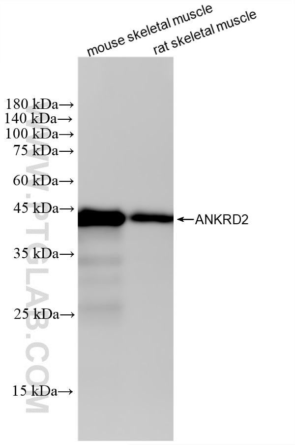 Western Blot (WB) analysis of various lysates using ANKRD2 Recombinant monoclonal antibody (87444-1-RR)